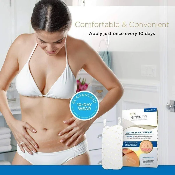 Embrace Scar Treatment - Silicone Sheets for New Scars with Active Scar Defense